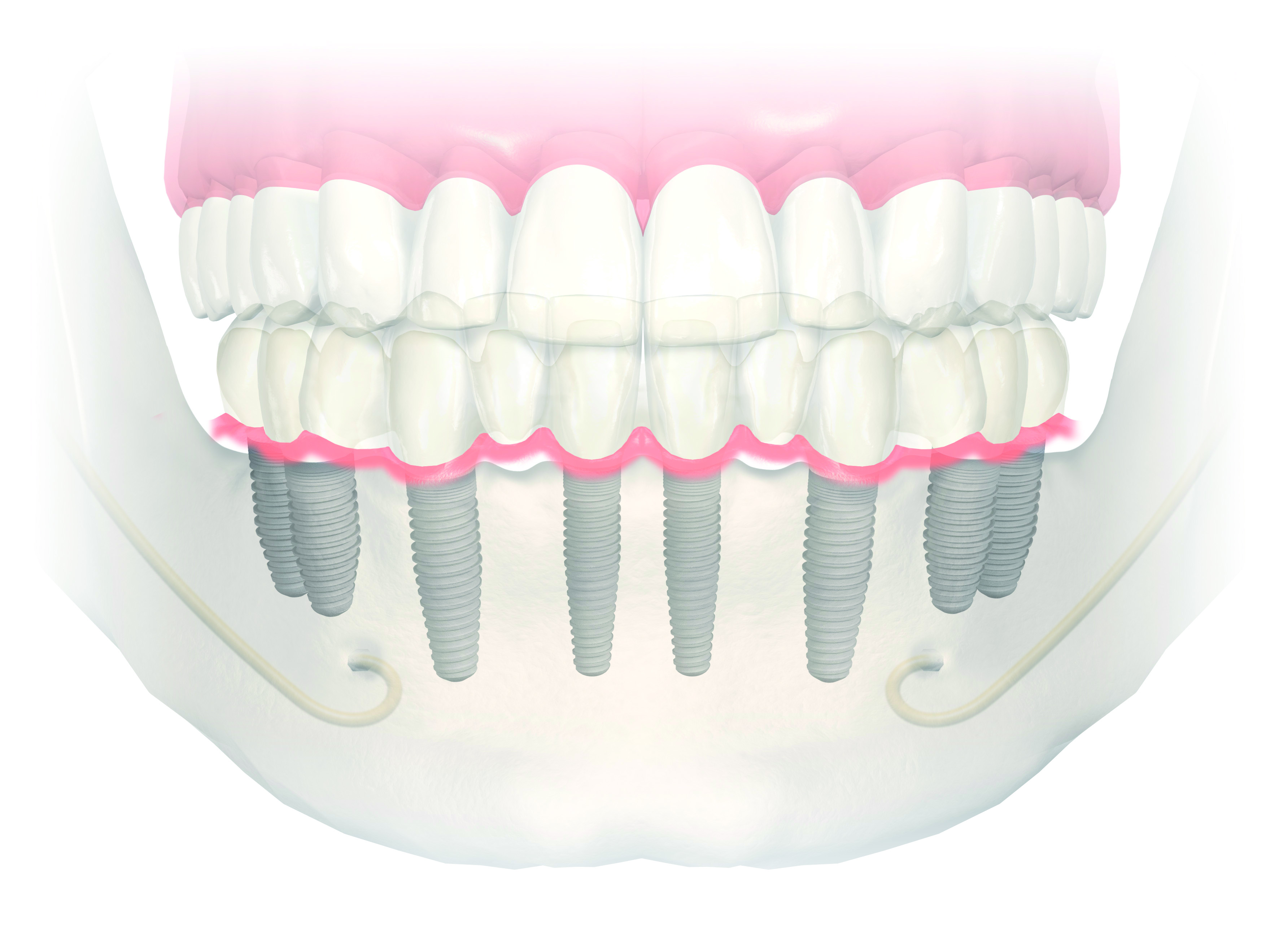 forpressrelease